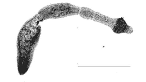  Echinostomum! Un parasite redoutable aux multiples facettes métamorphiques