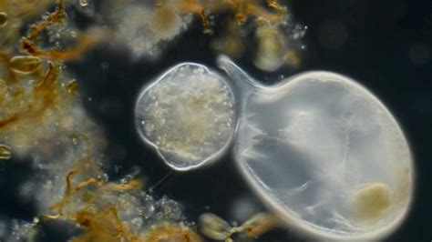  Naegleria: Un Prédateur Microscopique Qui Se Déplace Par Flagelle et Qui Chasse Ses Proies dans L’Eau Douce !