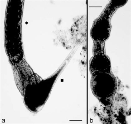  Stentor : Un Prédateur Agile au Stylet Inflexible qui Dévoile un Mystère Microscopique !